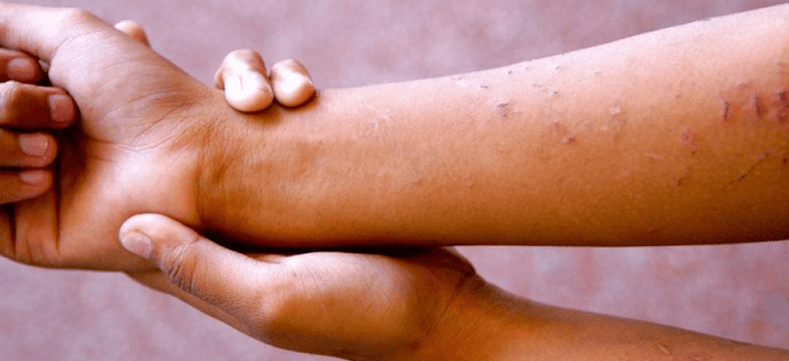 Les violences volontaires subies par l’enfant